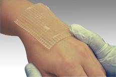 Первая медицинская помощь при ожогах классификация ожогов