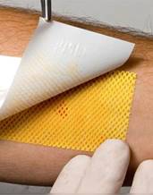 Первая медицинская помощь при ожогах классификация ожогов