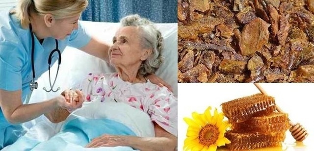 Народные средства от пролежней прополис