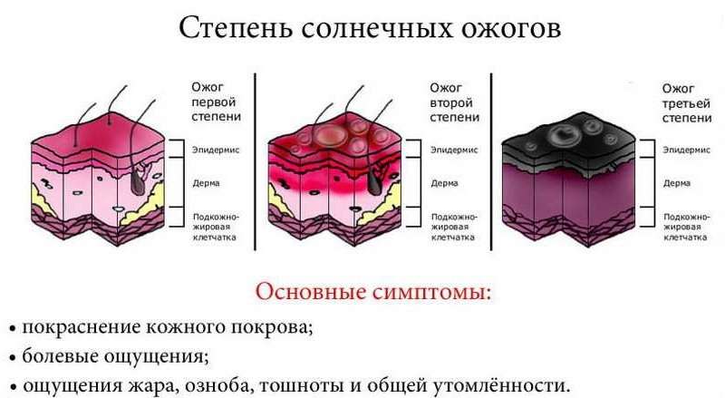 степени солнечных ожогов