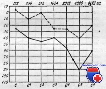 аудиограмма при остром отите