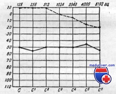 аудиограмма при остром отите