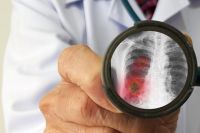 Пневмония что делать если нет врача