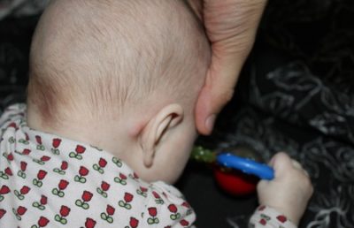 Волдыри на пальцах рук у ребенка похожие на ожог не чешется и не болит