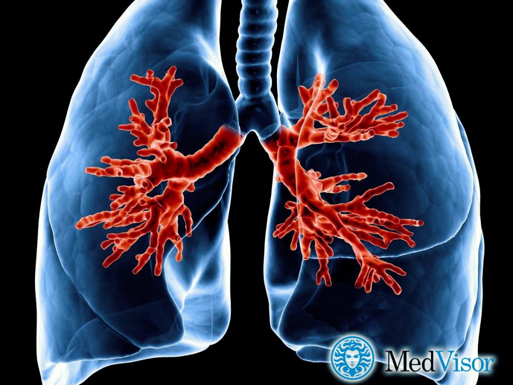 Острый бронхит Бронхит с пневмонией лечение у взрослых