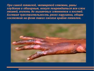 Химические ожоги презентация скачать бесплатно Химические ожоги презентация скачать бесплатно thumbnail
