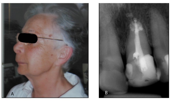 Гипохлориьовая авария: симптомы, помощь Гипохлориьовая авария: симптомы, помощь