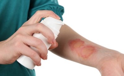 Как быстро убрать волдыри после ожога