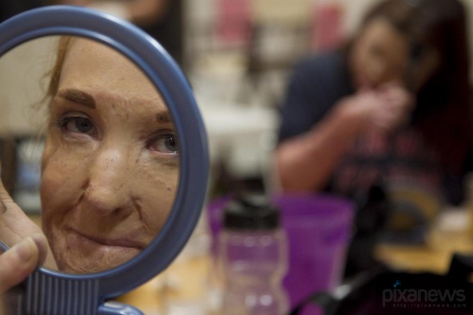 Ожог Ангельского лица (9 фото)