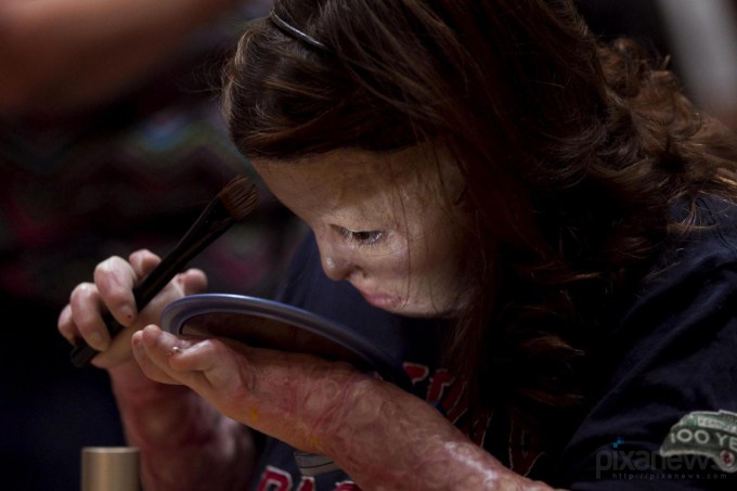 Ожог Ангельского лица (9 фото)