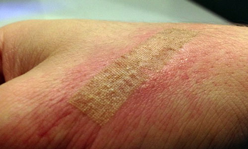 Толкование снов ожог на теле Толкование снов ожог на теле thumbnail