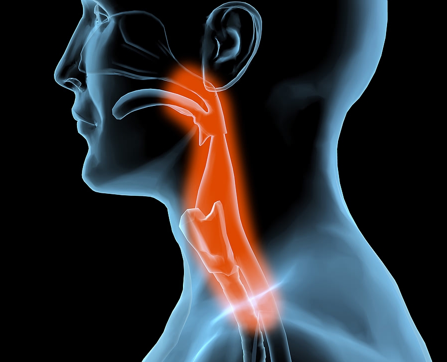 Ожоги верхних дыхательных путей