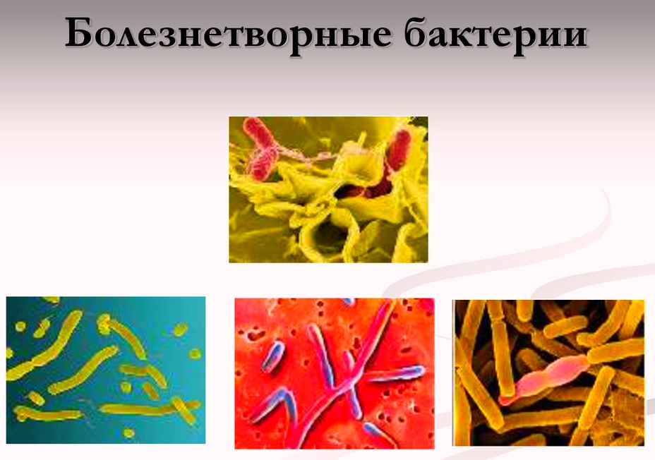 Клебсиелла пневмония в зеве у взрослого лечение Клебсиелла пневмония в зеве у взрослого лечение thumbnail