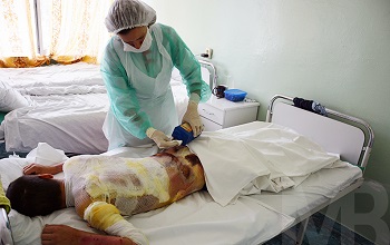 Первая помощь при ожоге третьей степени в условиях стационара