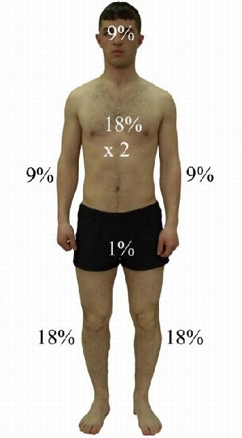 Правило девяток