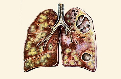 Пораженный орган