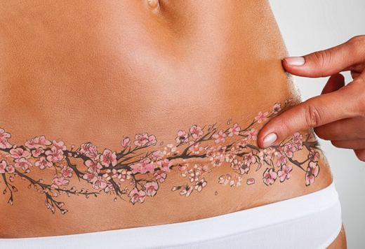 перекрытый татуировкой шрам на животе