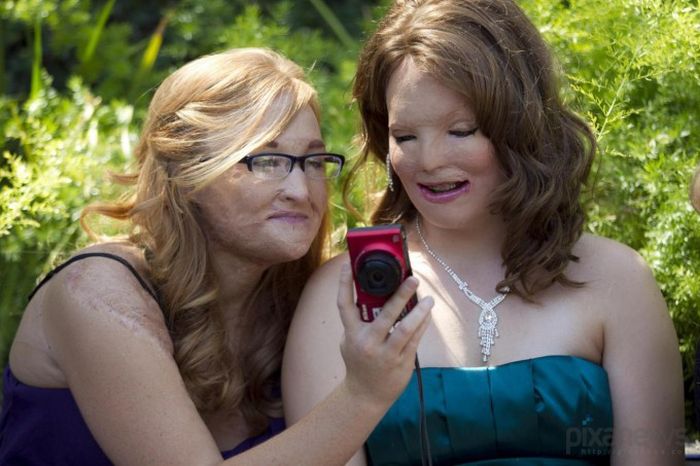 Ожог Ангельского лица (9 фото)